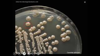 Candida albicans culture pathogenesis and laboratory diagnosis [upl. by Elleirb888]