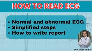 Mastering ECG Reading  Simplified Guide for Interns General Practitioners and Medicine Residents [upl. by Mirak]