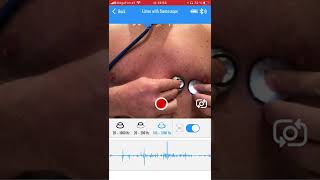 Heartbeat auscultation stethoscope heart sounds at rest mitral valve membrane  LD pediatric [upl. by Llewkcor]