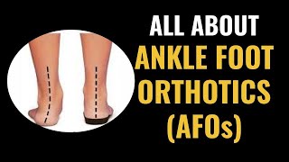 Types of AFOs Ankle Foot Orthotics for common foot conditions [upl. by Anilef]