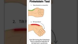 Finkelstein testthephysiodoctorsportsphysiotherapykneepainreliefhumananatomyhamstringinjury [upl. by Anir]