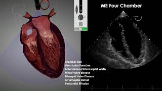 Transesophageal Echocardiography TEE Imaging [upl. by Olrac733]