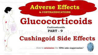 Glucocorticoids Adverse Effects Part 9  Corticosteroid Contraindications  Cushings Syndrome [upl. by Smada]