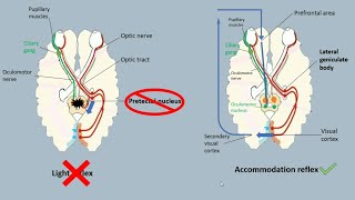 Argyll robertson pupil  light vs accomodation reflex [upl. by Riha]