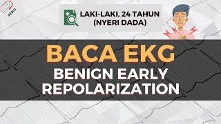 BACA EKG BENIGN EARLY REPOLARIZATION  EP2 [upl. by Azar322]