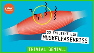 Wie entsteht ein Muskelfaserriss  trivialgenial  DAKGesundheit [upl. by Eenafit161]