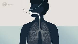 Bronchoscopy  examination of your airways English version [upl. by Caruso556]