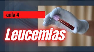 LEUCEMIAS  AULA 4  Hematologia [upl. by Iuqcaj2]