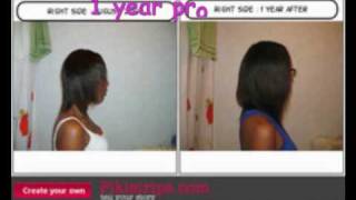 Healthy hair journey  1 year of progresses slide show  by request [upl. by Nylirret]