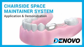 Pediatric Chairside Space Maintainer system — Application amp demonstration [upl. by Iren523]