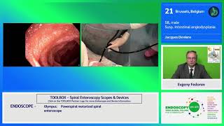 EOA 2020 Case 17 spiral enteroscopy Deviere [upl. by Connor]