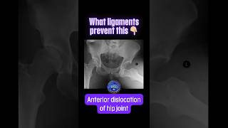 What ligaments prevent the anterior dislocation of hip joint shorts drsamsanatomyclasses [upl. by Auhso762]