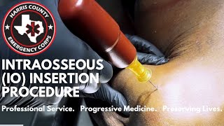 Intraosseous IO Insertion Procedure [upl. by Gamaliel559]