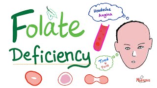 Folate deficiency  Megaloblastic Anemia  Macrocytic  Hematology Series [upl. by Yramesor]