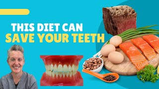 How To Use The Keto Diet To Fix Tooth Decay and Gum Disease [upl. by Redman]