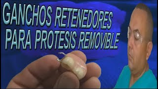 GANCHOS RETENEDORES PARA PRÓTESIS DENTAL REMOVIBLE [upl. by Nosaes]