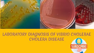 Laboratory diagnosis of Vibrio cholerae in hindi [upl. by Rocco]