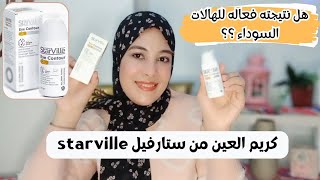 كريم ستارفيل للعين starville eye contour gel للهالات السوداء والإنتفاخات وهل فعال في علاج الهالات⁉️ [upl. by Etnod]