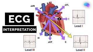 How to Read an ECG  ECG Interpretation  EKG  OSCE Guide  UKMLA  CPSA [upl. by Corette752]