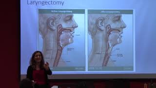 Tracheostomy Emergencies When Breathing Through Your Neck Goes Bad [upl. by Parrisch677]