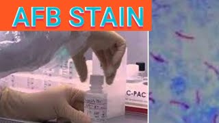 Sputum AFB stain procedure Acid fast staining Sputum staining procedure  laboratorymicrobiology [upl. by Hadeehsar]