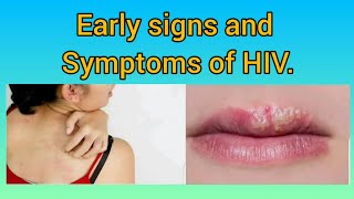 12 early signs and symptoms of HIV infection [upl. by Radbourne]