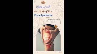 plica syndrome متلازمة الثنية [upl. by Palermo]