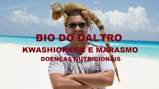 KWASHIORKOR E MARASMO  CASOS DE DESNUTRIÇÃO [upl. by Kazmirci]