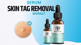 Skinfix Skin Tag Removal Review  Serum Skin Tags  Benefits Ingredients How to use [upl. by Egas521]