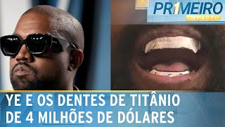 Kanye West gasta R 4 mi para colocar prótese de titânio nos dentes  Primeiro Impacto 190124 [upl. by Cran]