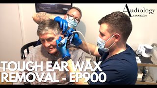 TOUGH EAR WAX REMOVAL IT TOOK BOTH OF US TO REMOVE   EP900 [upl. by Meesak]