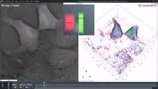 Fibroblastic Reticular Cell FRC Mitosis [upl. by Ainod549]