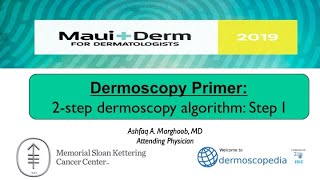 2Step Dermoscopy Algorithm Step 1 [upl. by Kathryn]