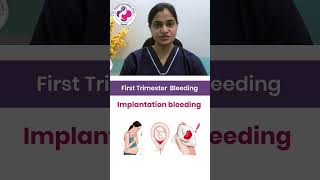 Is Implantation Bleeding Causing Your Spotting Watch Dr Mayuri Kothiwala’s Expert Guide [upl. by Yroc]