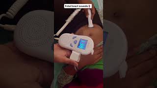 Fetal heart sounds using Doppler⭐️ [upl. by Aurlie377]