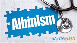 Albinism ¦ Treatment and Symptoms [upl. by Oos]