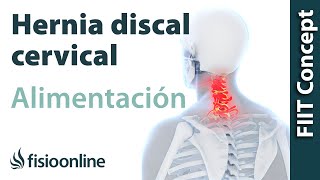 Hernia discal cervical derecha Alimentación nutrición y modificaciones en la dieta [upl. by Traggat]