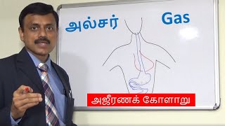 அல்சர் மற்றும் கேஸ் பிரச்சினை ULCER AND GAS PROBLEMS [upl. by Soinotna]