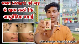 Wartosin Wart Remover  how to remove warts from skin [upl. by Keever721]