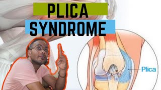 كل ماتريد معرفته عن متلازمة البلايكا  plica syndrome [upl. by Mita]