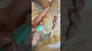 Full foot callus removal  Epidermolytic Palmoplantar Keratoderma  Jan 30 2023 [upl. by Otilia]