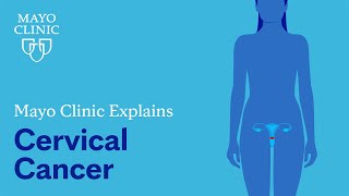 Mayo Clinic Explains Cervical Cancer [upl. by Gilles]