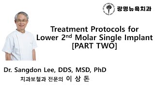 Treatment Protocols for Lower 2nd Molar Single Implant PART 2 [upl. by Dnumde713]