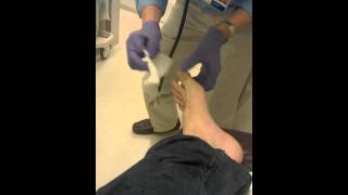 How to Reset a dislocated toe [upl. by Logan]