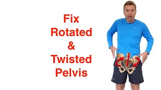 Best Rotated Pelvis Correction Exercises [upl. by Uriia]