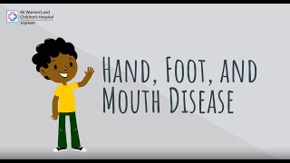 Hand Foot And Mouth Disease [upl. by Eirojam]