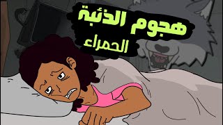 مرض العصر متأخر التشخيص الذئبة الحمراء  lupus [upl. by Filippo]