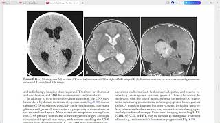 PAEDIATRIC IMAGING [upl. by Ymmak94]