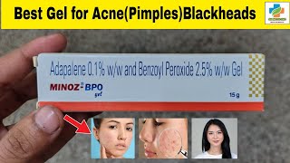 Minoz BPO Gel Use in Hindi  Minoz BPO Gel Benefits Side effects  Acne  Blackheads  SK Medicine [upl. by Fachini]