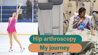 Ep 1 What to expect on the day of surgery  FAI and labrum tear hip impingement surgery [upl. by Sabas329]